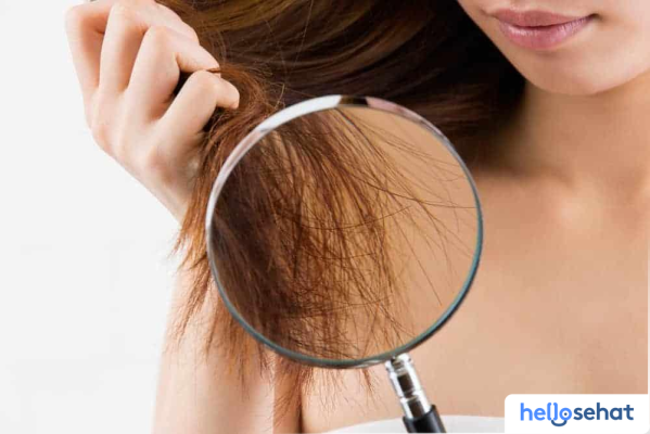 Rahasia Atasi Rambut Bercabang: Penyebab & Solusi Ampuh