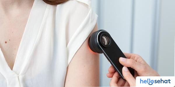 Rahasia Kulit Sehat Terungkap: Panduan Lengkap Dermoskopi